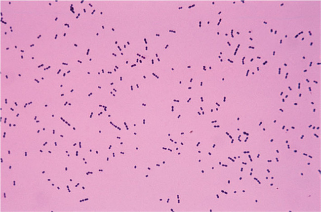 ballon Poleret I virkeligheden Bakterier, sygeplejersker bør kende | Mikrobiologi